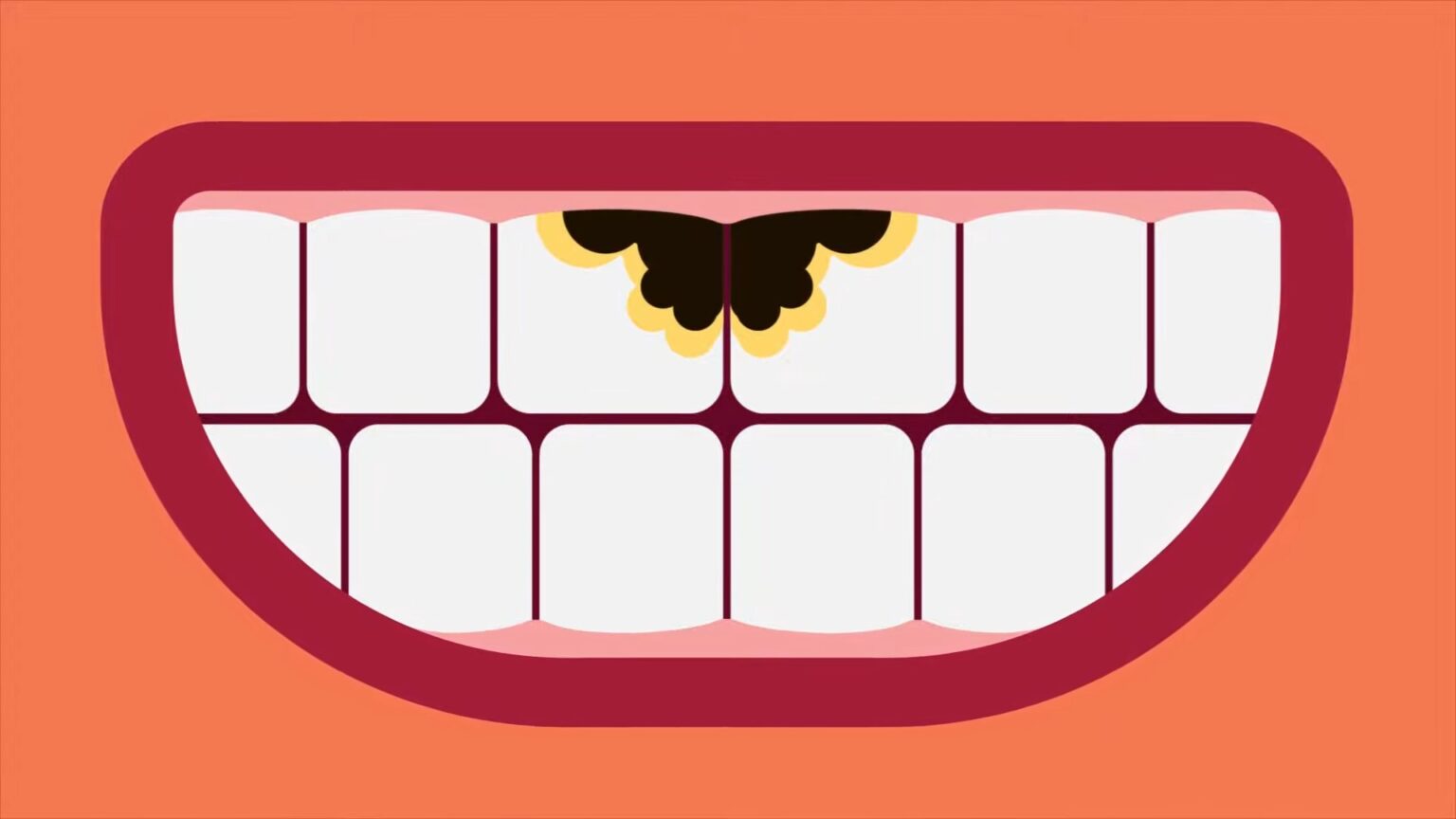 Eating Pickles Before Bed? The Surprising Things You Need To Know